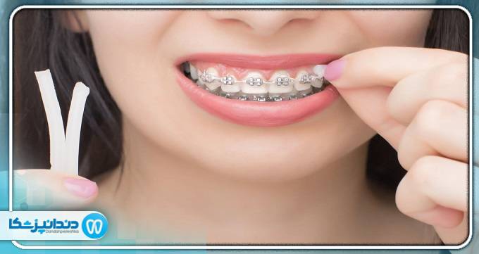 ارتودنسی چیست؟